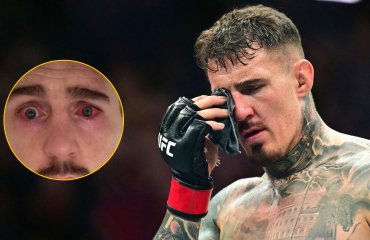 არის შანსი ვეღარ იჩხუბოს | ტომ ასპინალს სერიოზული პრობლემები აქვს